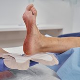 DracoFoam Ferse haft Anwendung