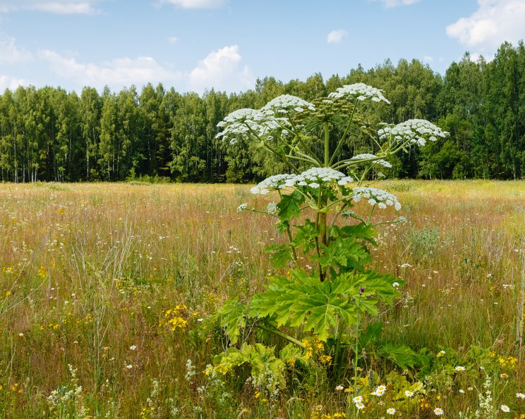 Verbrennungen durch Riesen-Bärenklau
