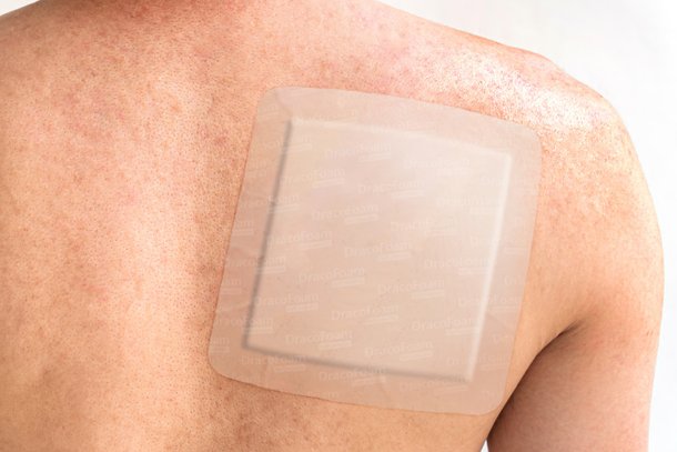 Große sanft haftende Wundauflage Dracofoam haft sensitiv