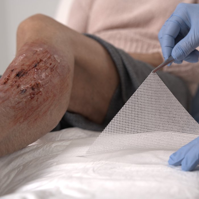 DracoTüll Silikon 10x20cm, Anwendung