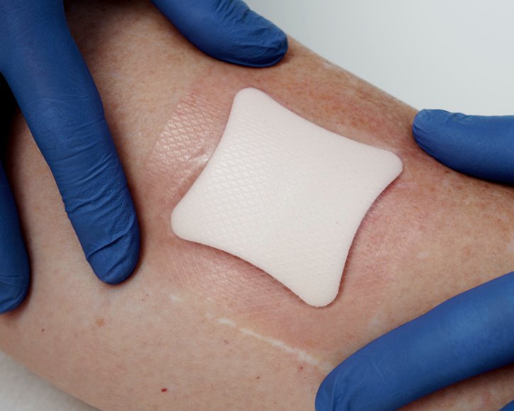 Leitfaden: Wundauflagen gezielt einsetzen 