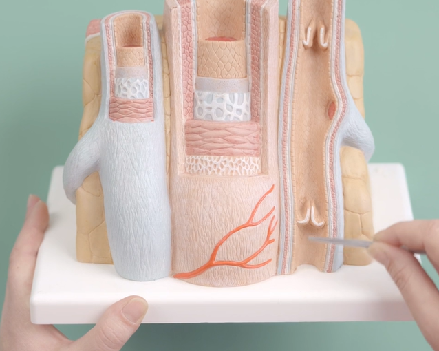 CVI-Klassifikation nach Widmer