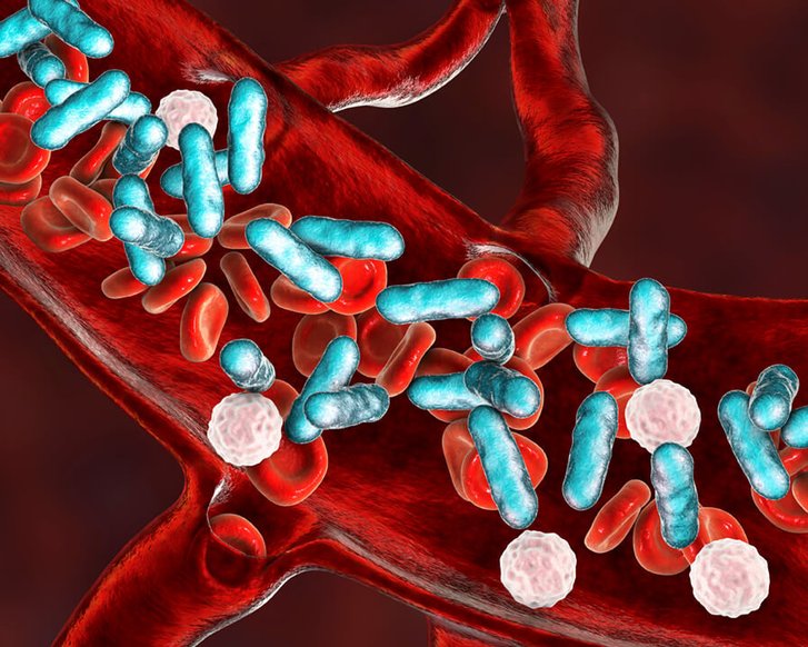 Sepsis früh erkennen und schnell handeln: Was Sie wissen sollten