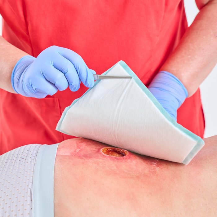 DracoSuperabsorber Anwendung