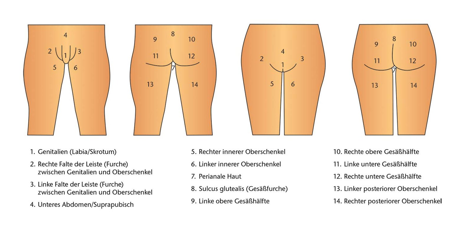 Grafik der sich befindenden praedilektionsstellen