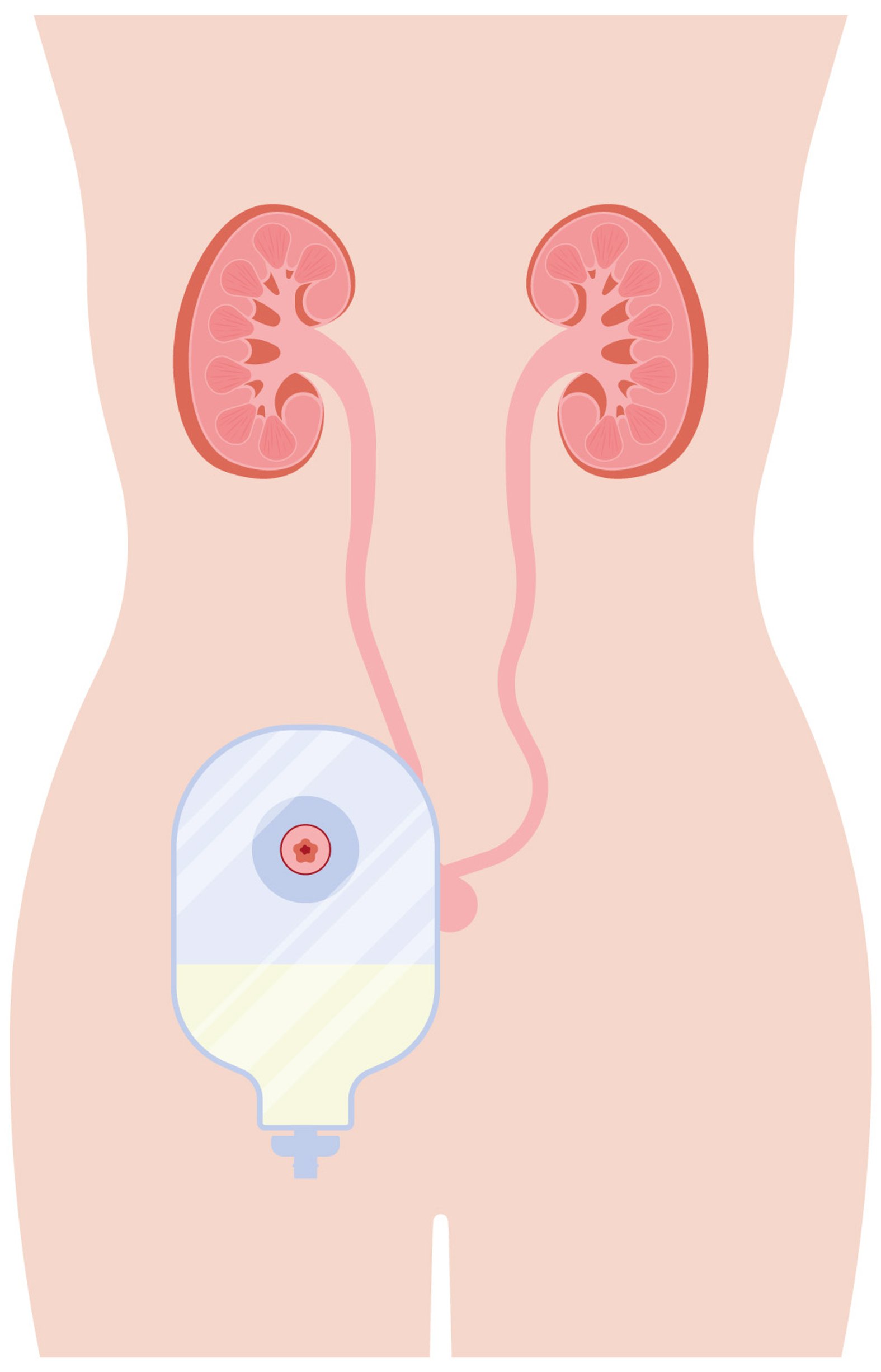 Urostoma, schematische Darstellung