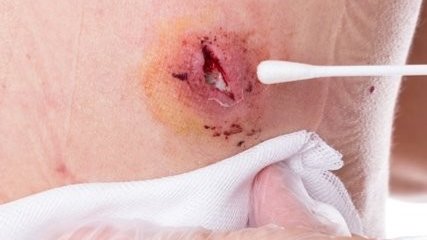 Mikrobiologische Diagnostik