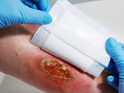 Anwendung Wunde News Kachel