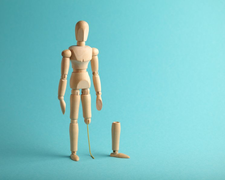 Mangled Extremity Severity Score (MESS): Entscheidungshilfe bei drohenden Amputationen