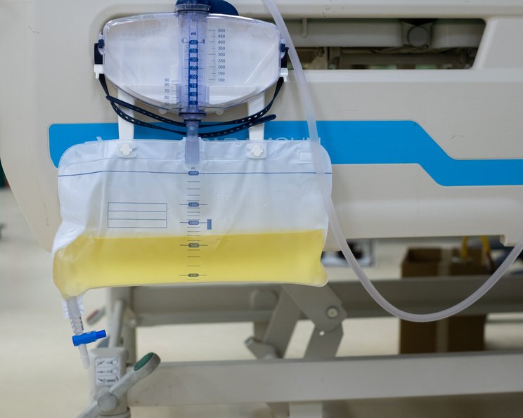 Der suprapubische Blasenkatheter: 5 Tipps zur korrekten Pflege