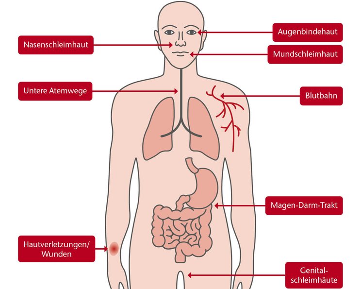 Infektionsquellen und Infektionswege