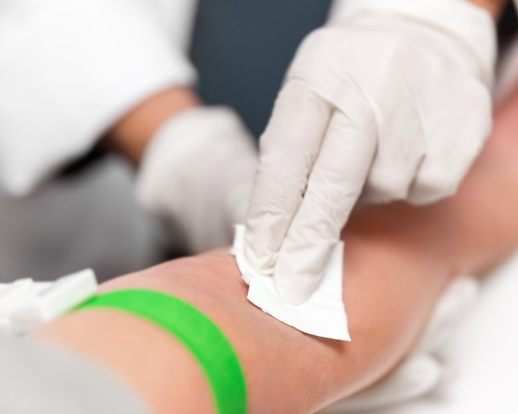 Punktionen und Biopsien