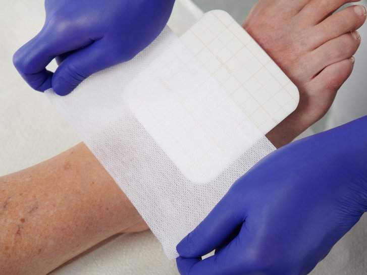 Fixierung einer DracoFoam Schaumstoff-Wundauflage