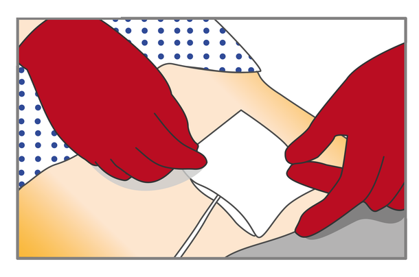 verbandwechsel-katheter-schritt-5