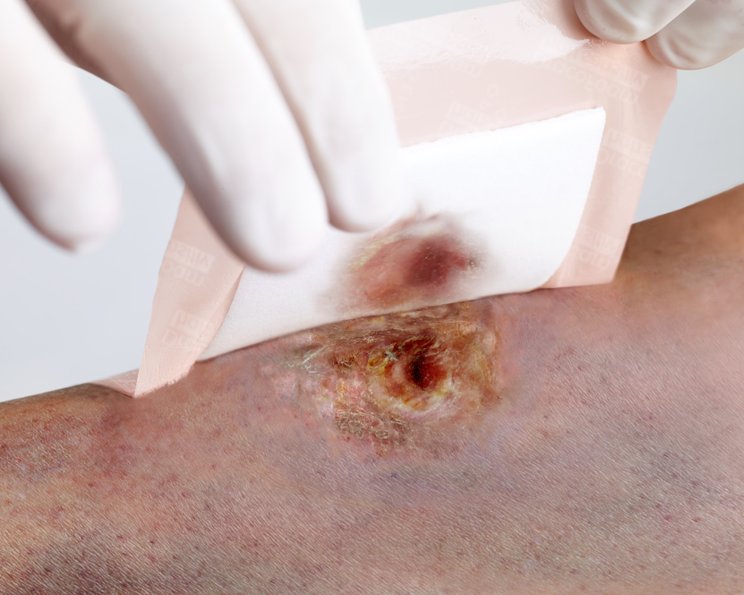 Alters- und Pergamenthaut