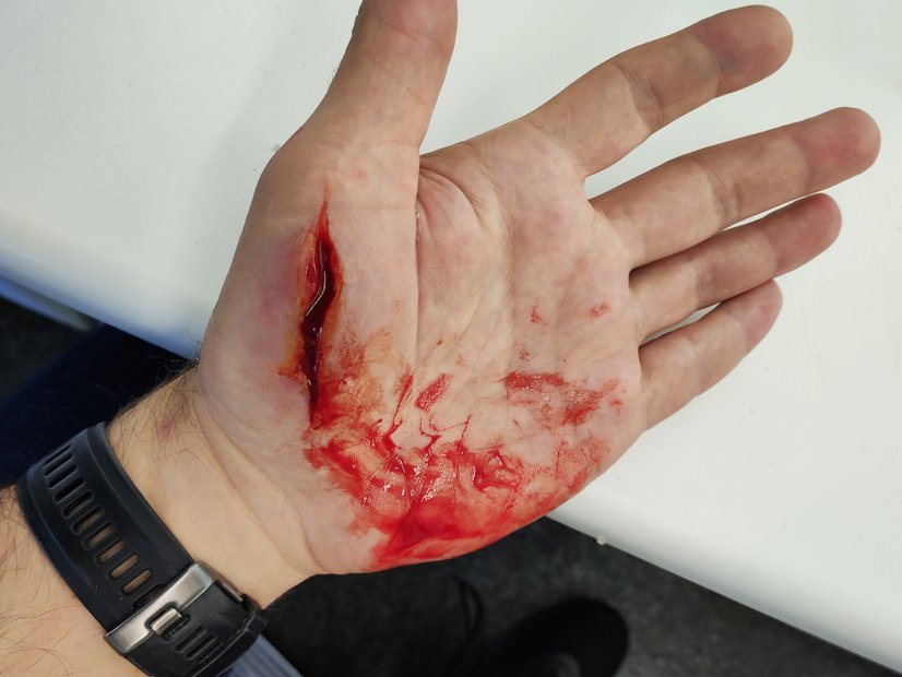 Schnittwunde Hand