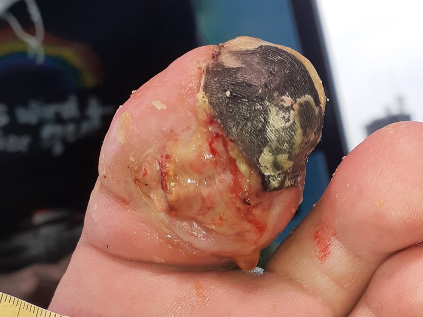 Ausgangssituation der nekrotischen Wunde (Tag 1)