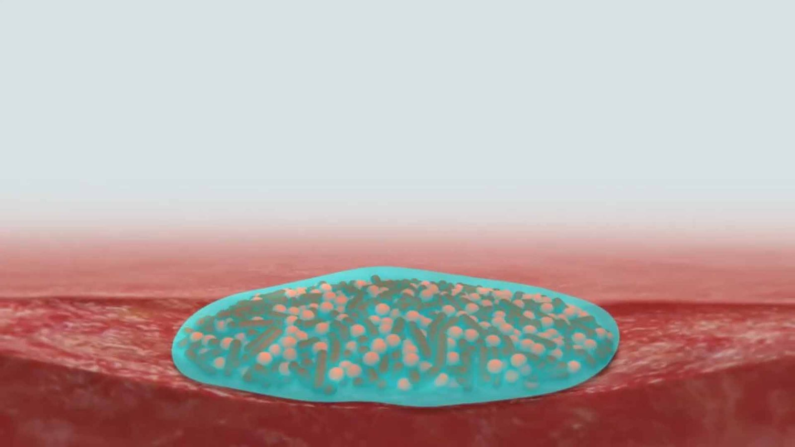 Vermehrung von Biofilm