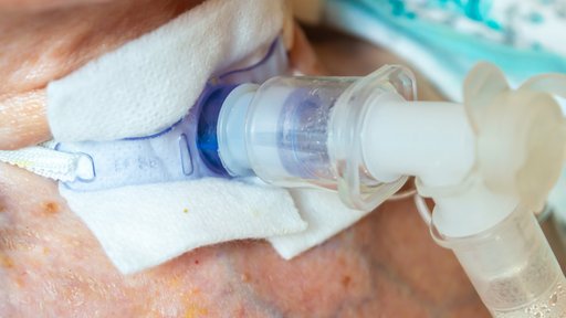 Tracheostoma am Patienten