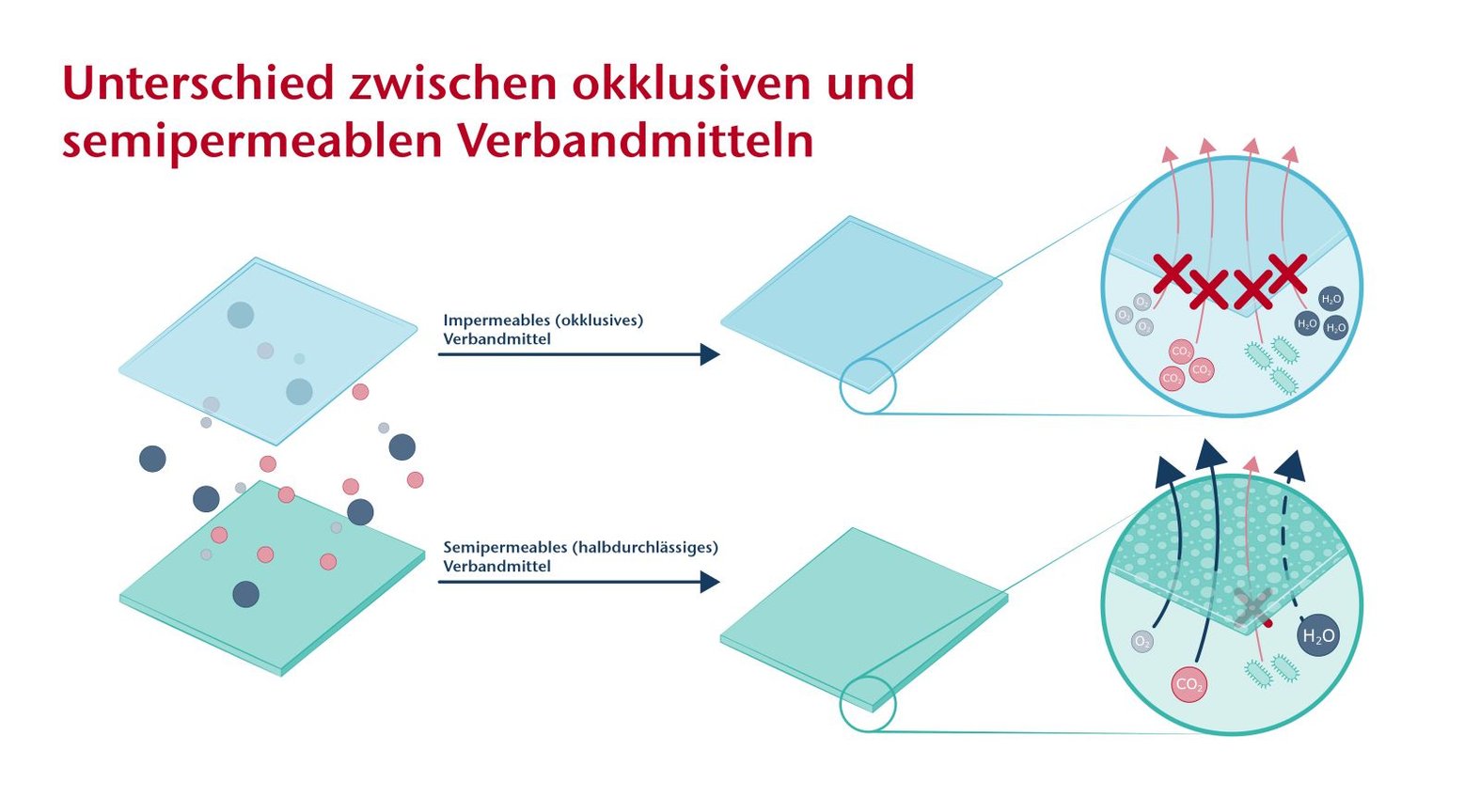 Schema: okklusive und semipermeable Verbandstoffe