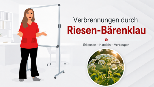 Verbrennungen durch Riesen-Bärenklau: Erkennen – Handeln – Vorbeugen