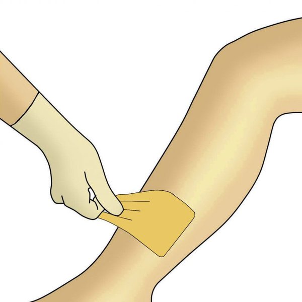 Dracohydro Verbandwechsel Schritt 6