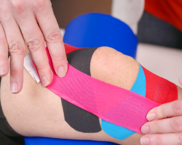 Knie tapen: bei Schmerzen und zur Unterstützung der Stabilität