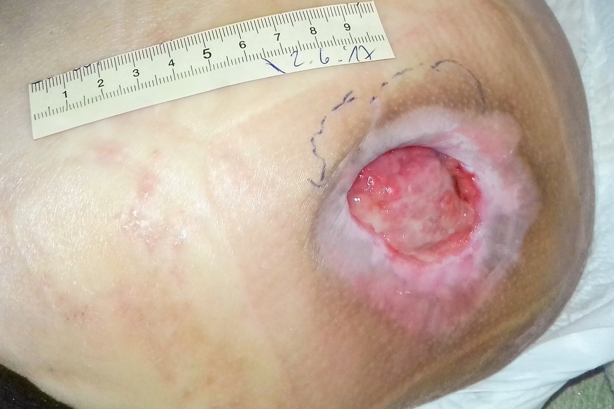 Foto 1: Ausgangssituation (Tag 1)