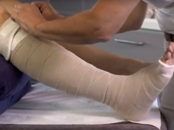 Kompressionsverband am Bein