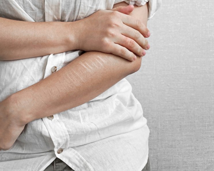 Artifizielle Wunden erkennen und behandeln