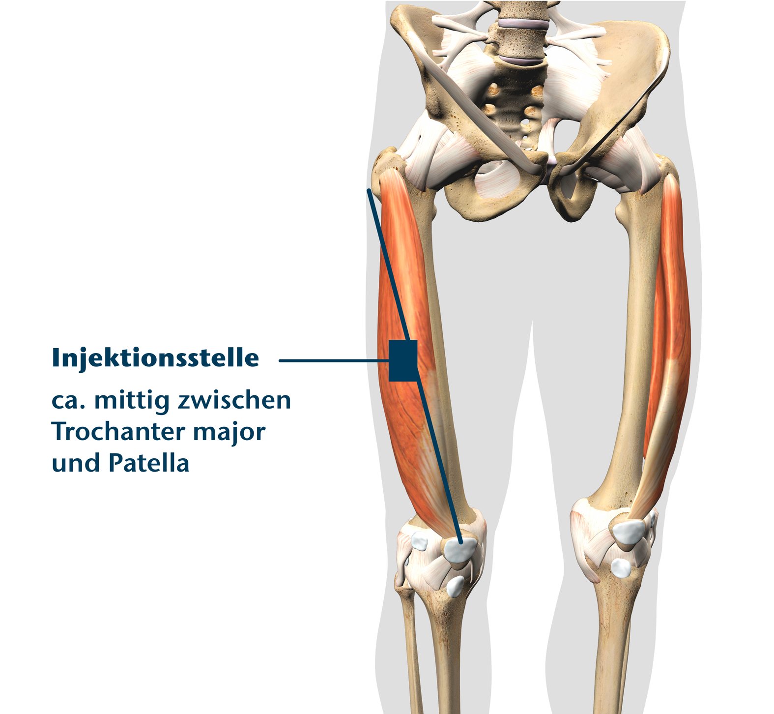 Injektionsstelle Abbildung