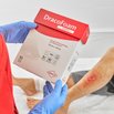 DracoFoam easyfix - MFA vor der Anwendung der Wundauflage beim Patienten