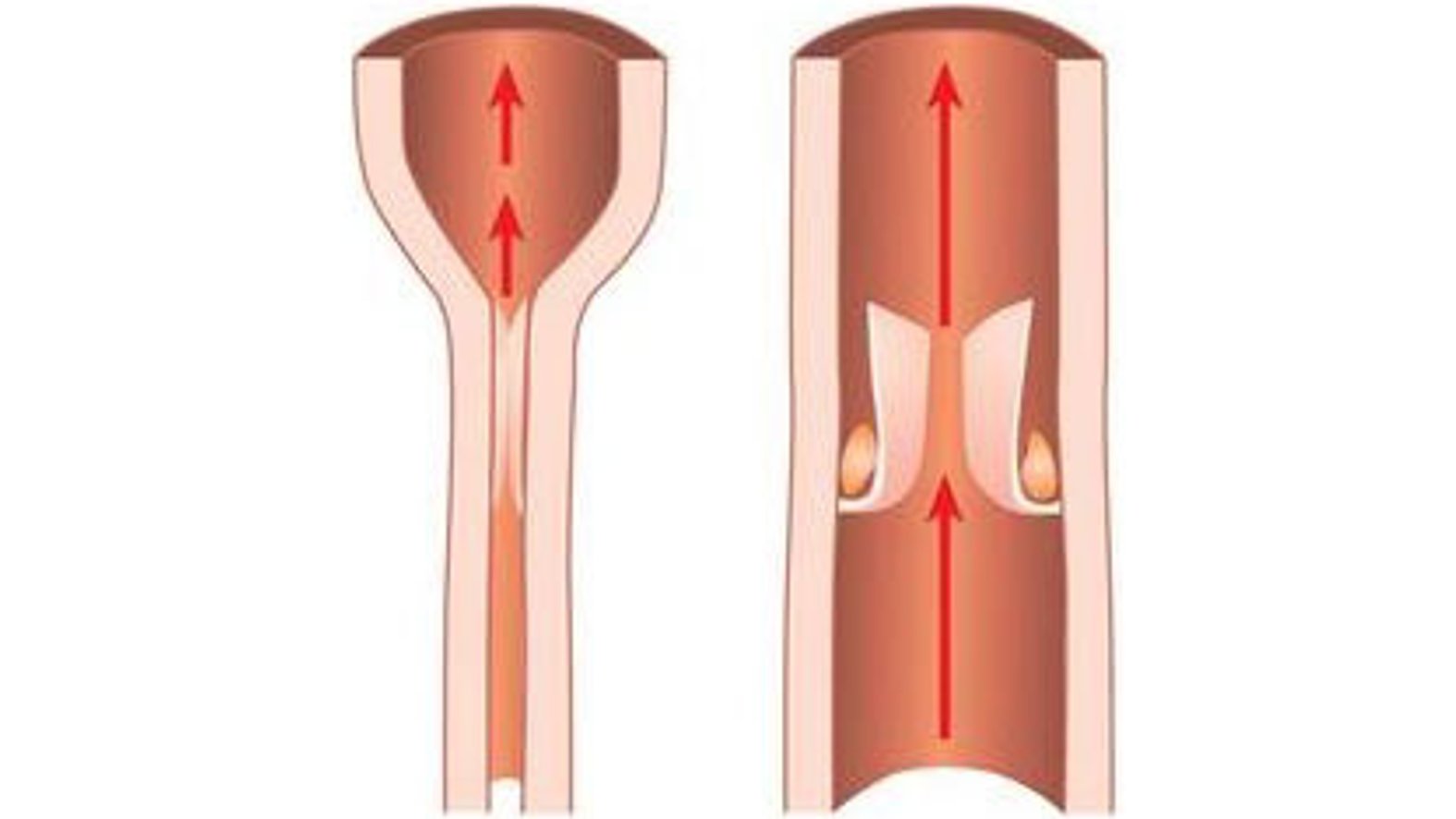 Wirkung Kompressionsstrümpfe