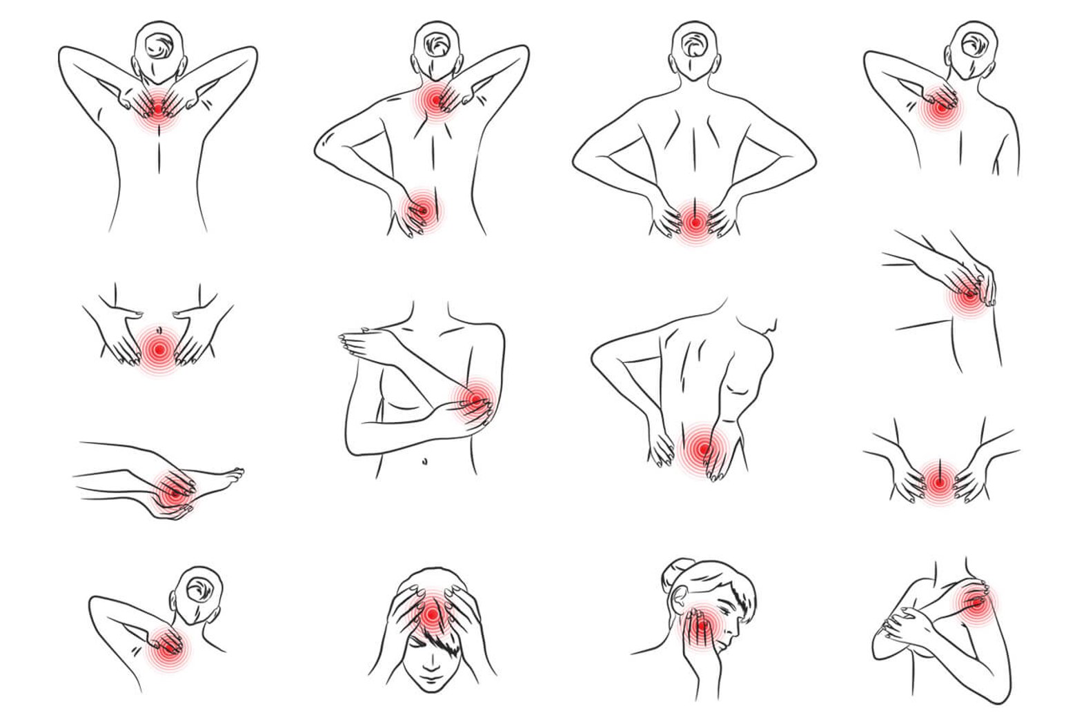 Schmerzlokalisierung, Darstellung typischer Schmerzherde.