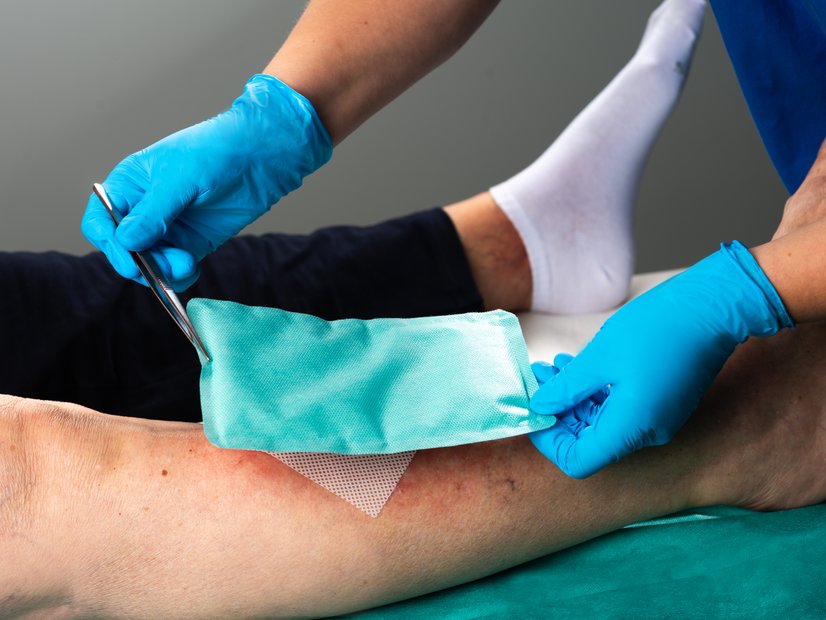 Superabsorber: Wundauflage, Anwendung auf Wunddistanzgitter