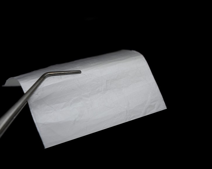 Gibt es bald eine neue Membran für die Wundheilung?