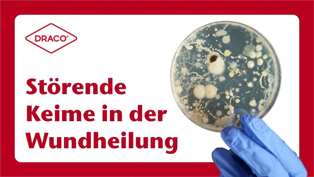 Video Thumbnail Störende Keime in der Wundheilung