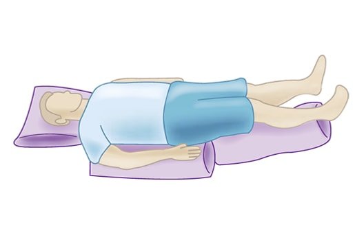 Zeichnung einer 30-Grad Dekubitus Lagerung
