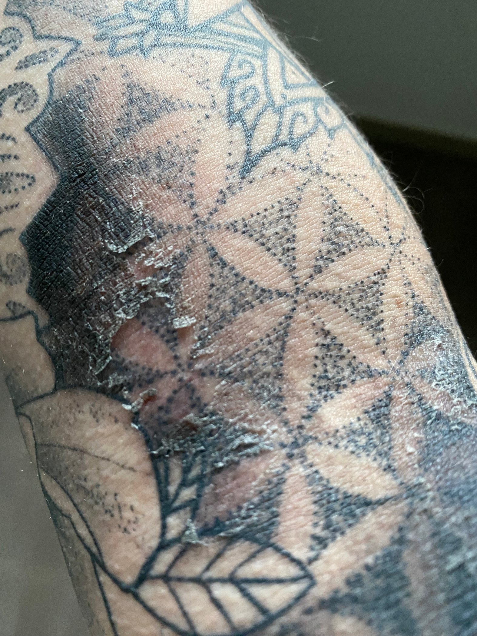 Tätowierung mit Schorfhaut