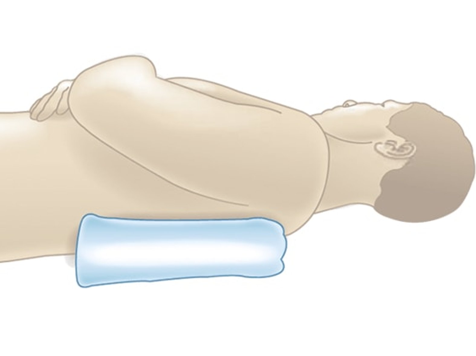 Zeichnung einer gefalteten Unterlage gegen Dekubitus