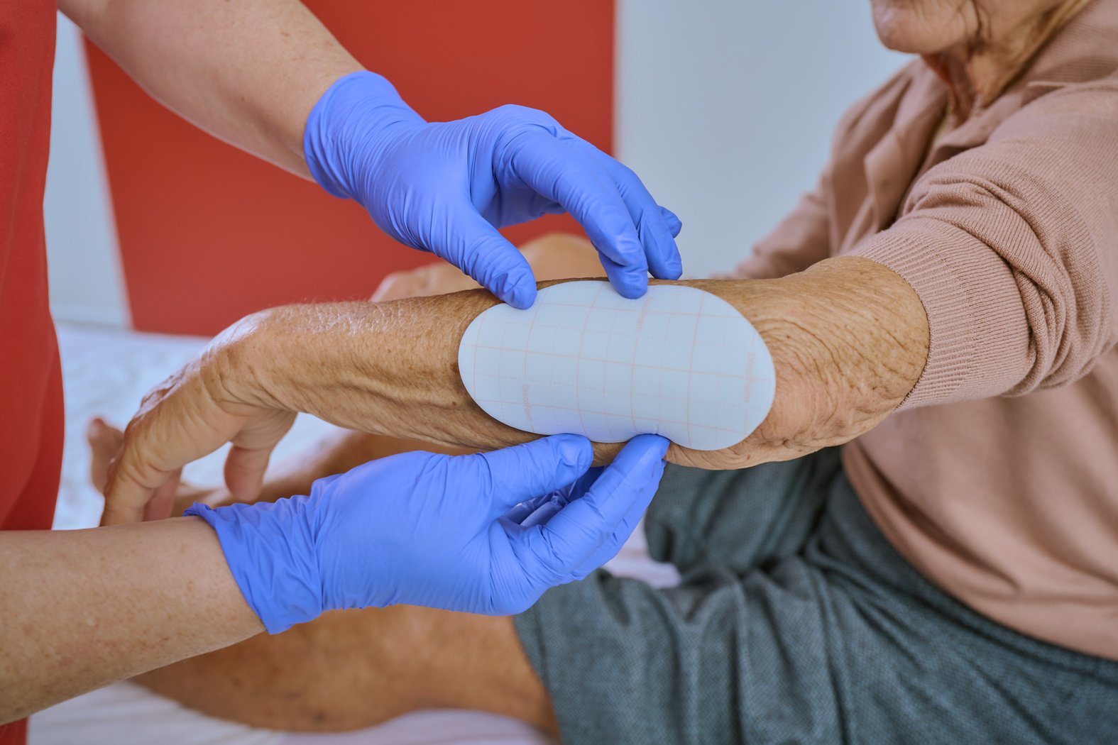 Dracofoam oval 16x6cm, Anwendung am Ellbogen