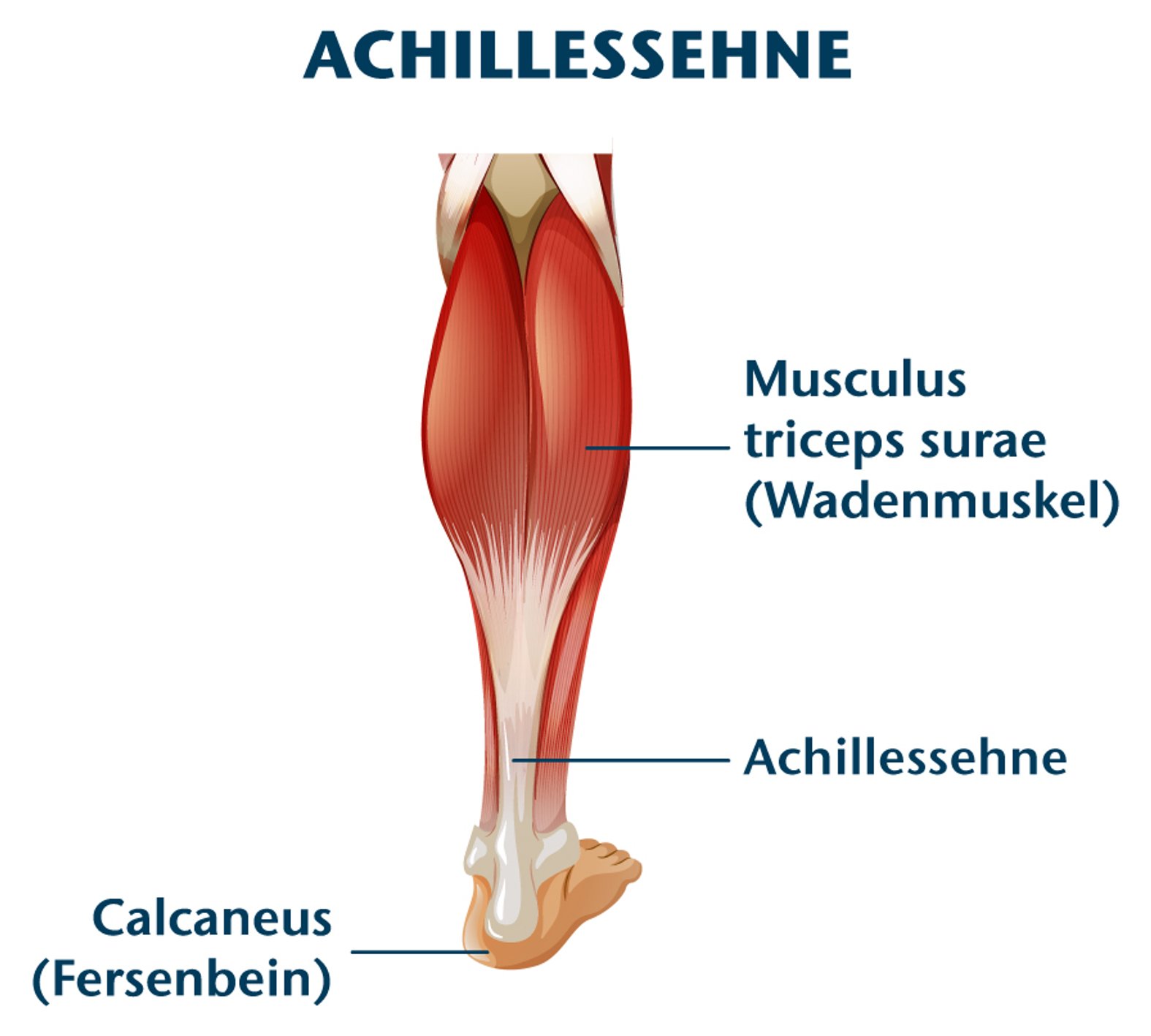 Anatomie der Achillessehne Abbildung