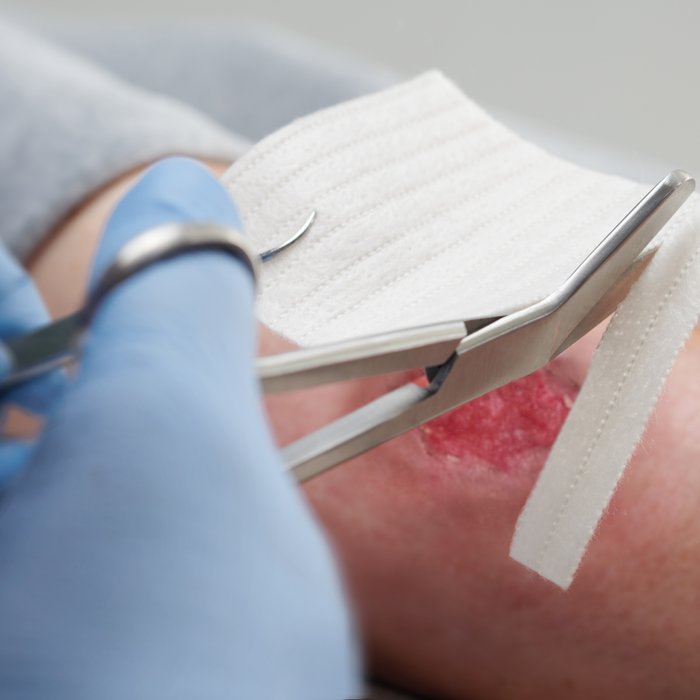 DracoHydrofaser - Applikation der Hydrofaser