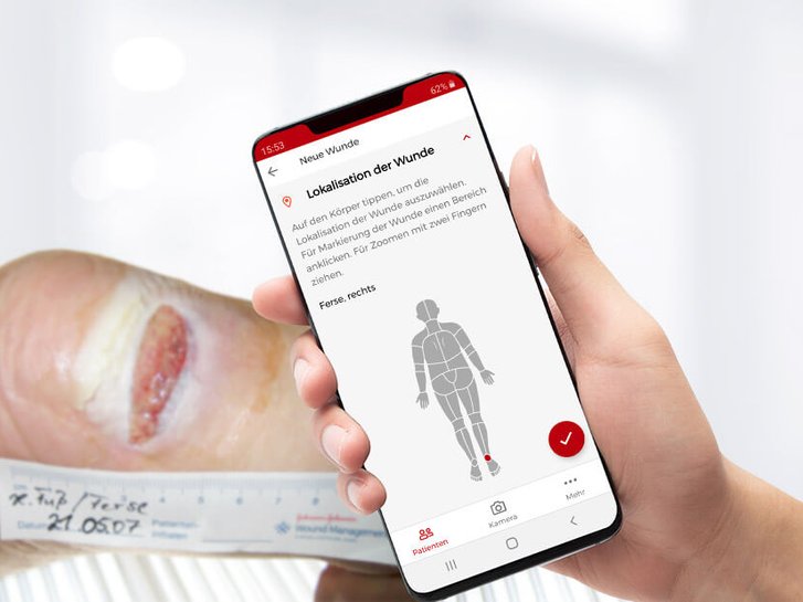 WundDoku App 2D Körpersimulation