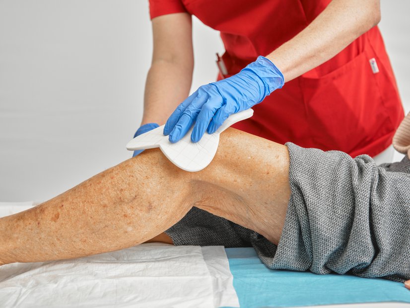 Dracofoam Multishape Schaumstoffwundauflage, Anwendung am Knie