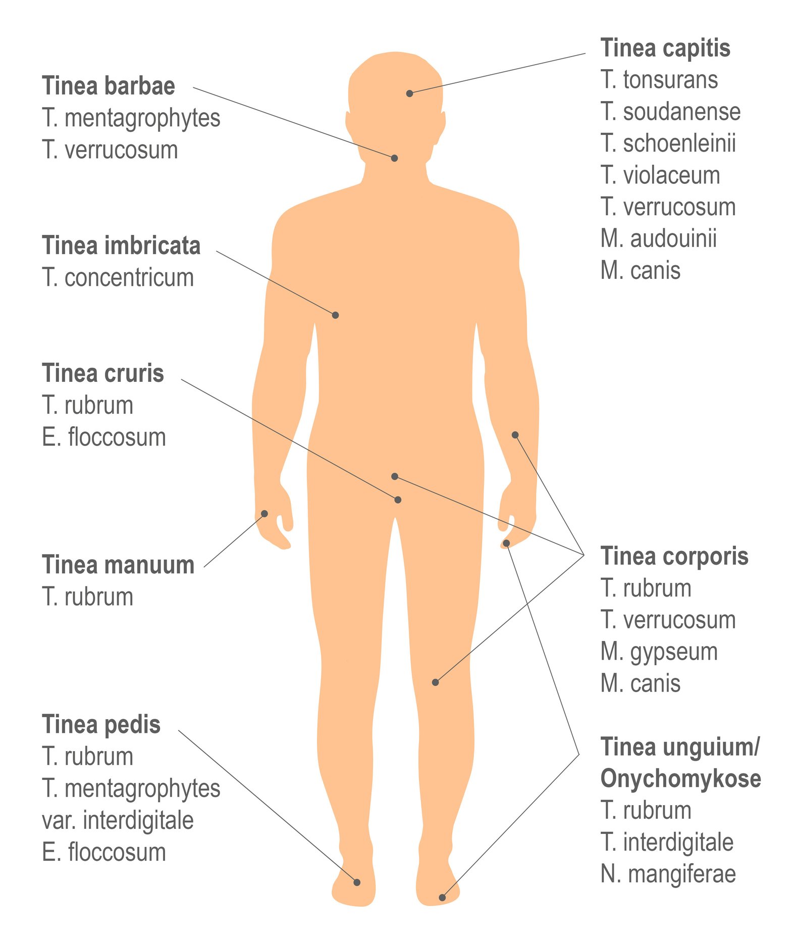 Typische Lokalisierungen von Dermatophytosen, Schema