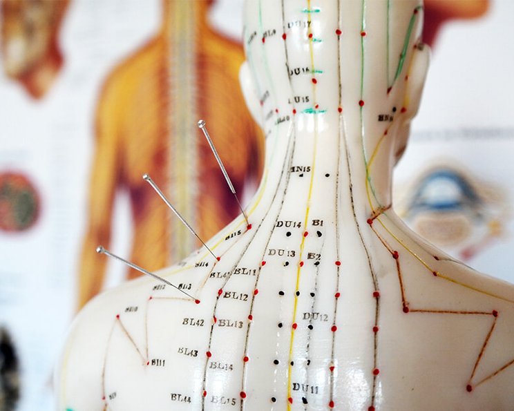 Nicht-medikamentöse Schmerztherapie