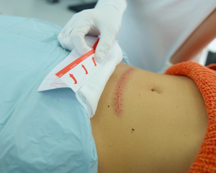 Operationen- und Prozedurenschlüssel (OPS-Ziffer)