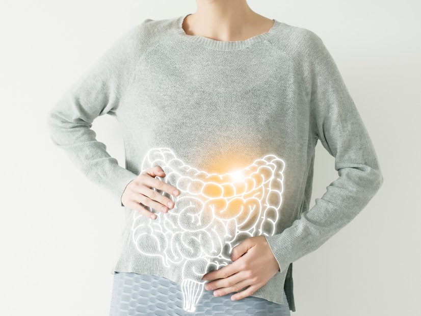 Morbus Crohn, entzündliche Darmerkrankung, Symbolbild