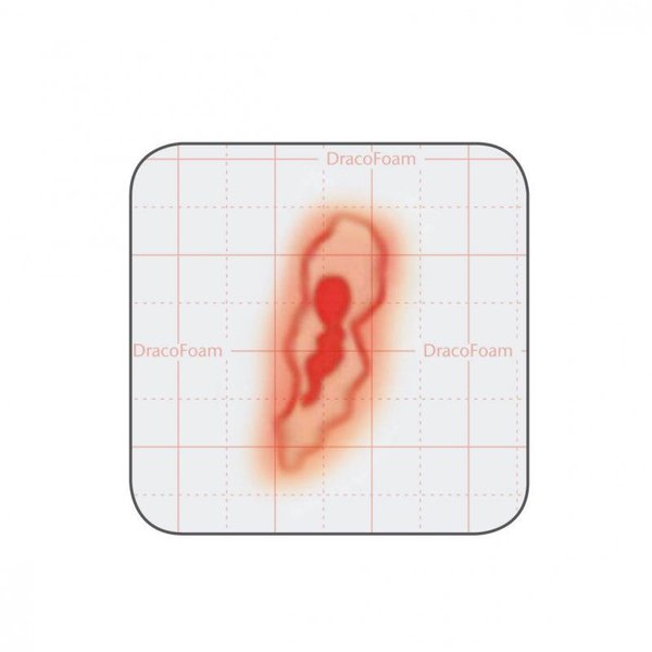 Dracofoam Verbandwechsel Schritt 4